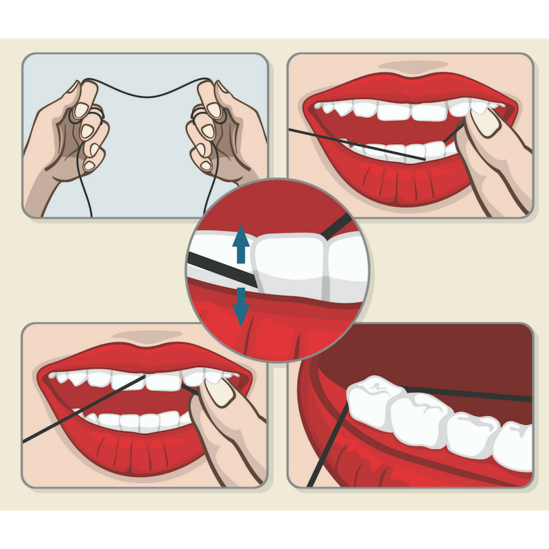 Así es como debes pasarte la seda dental